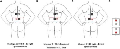 Lumbar trans-spinal direct current stimulation: A modeling-experimental approach to dorsal root ganglia stimulation